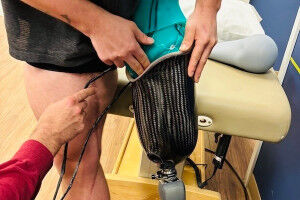 Researchers break the mould with new prosthetic design