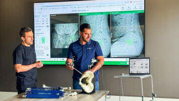 Intellijoint Surgical Inc. and Vena Medical awarded $1.9 million from Ontario's Life Sciences Scale-Up Fund